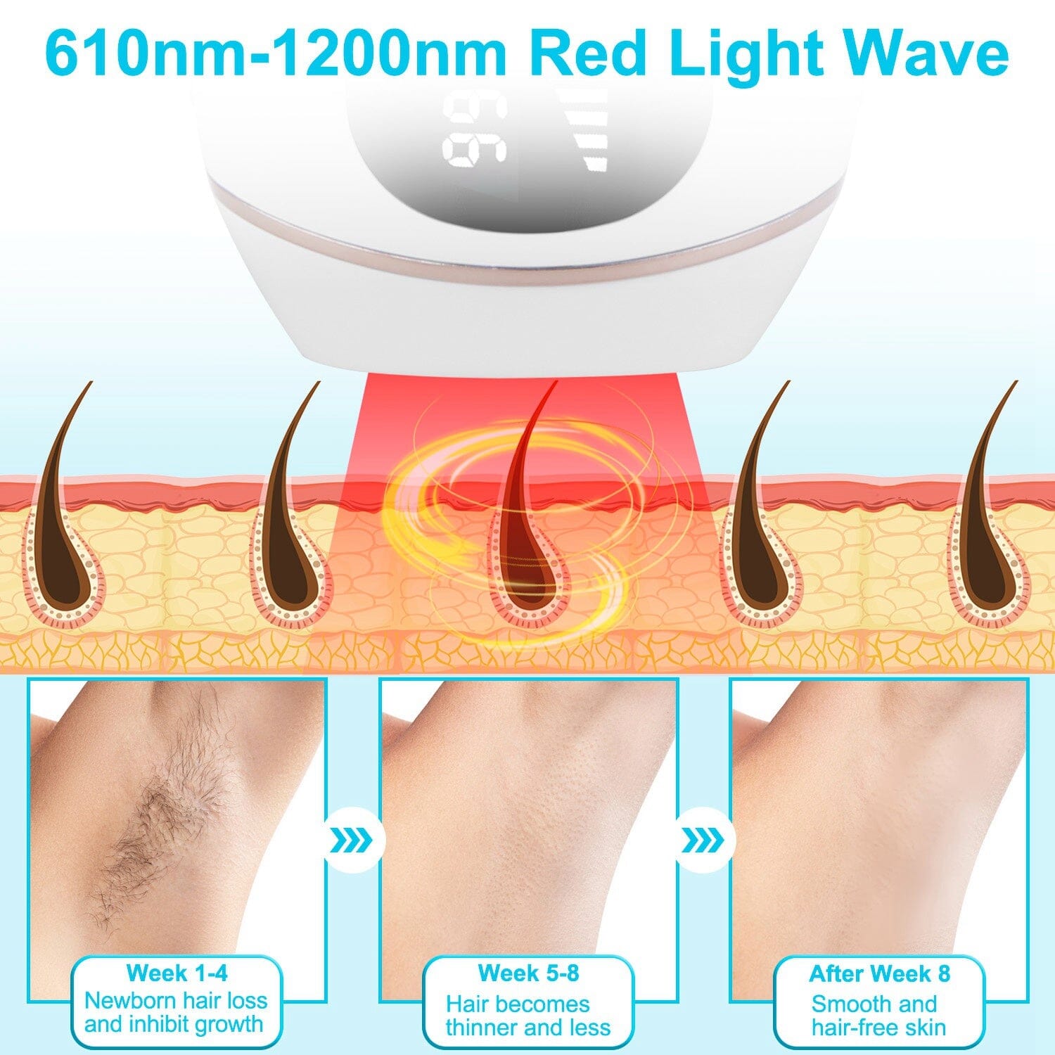 Laser Hair Removal Ice Cooling Permanent IPL Cheap Sale Reliable