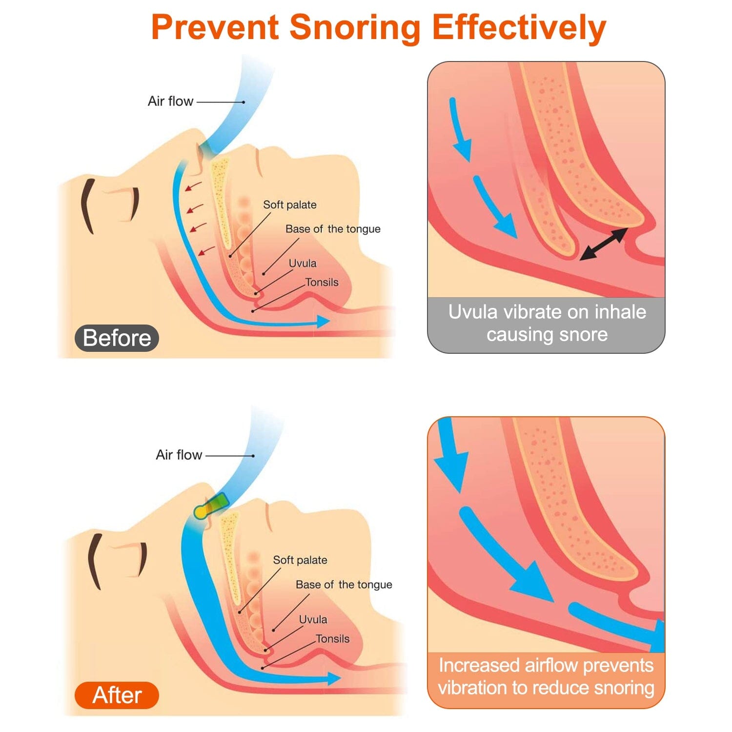 4-Pieces: Magnetic Nose Clip Anti Snoring Device Cheap Sale Enjoy