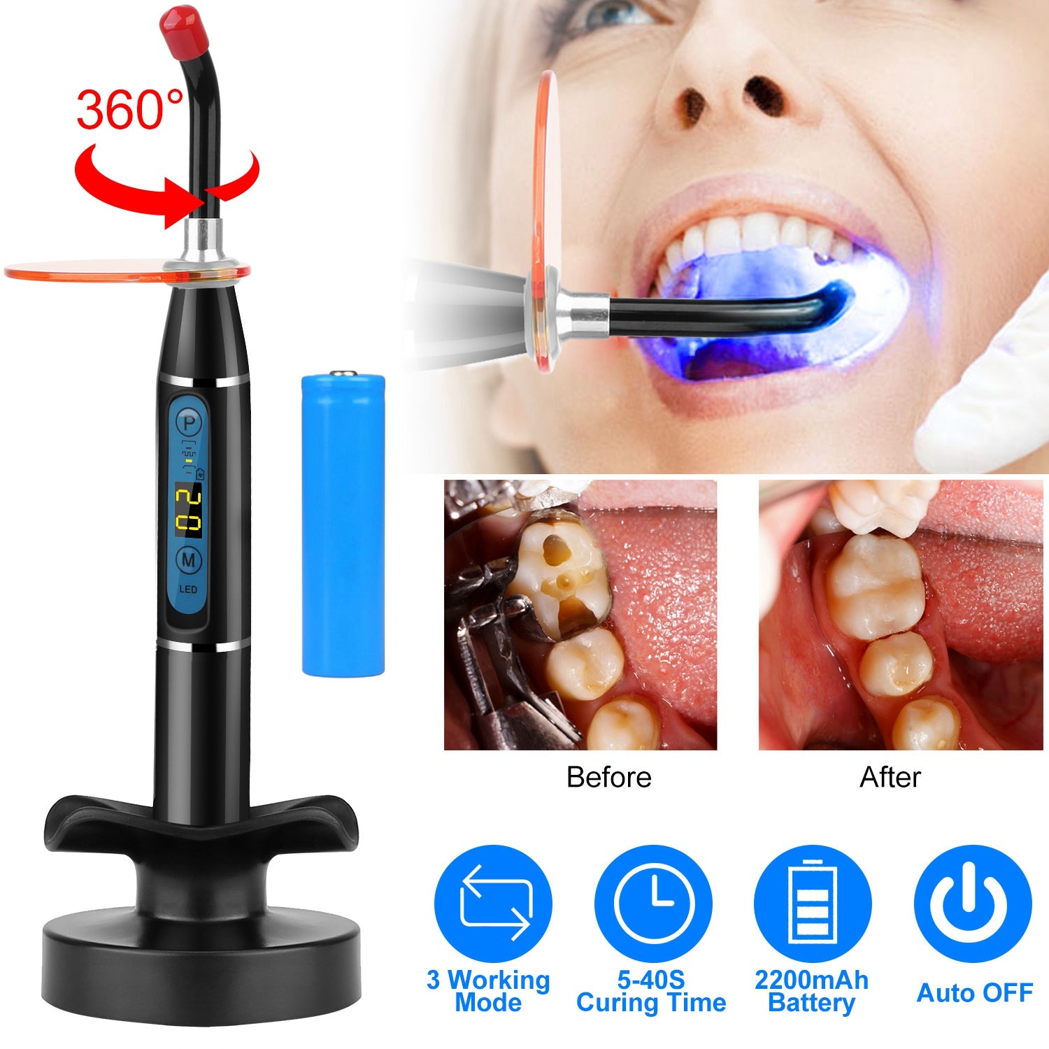 5W Cordless Dental LED Curing Light Cheap Sale Amazon