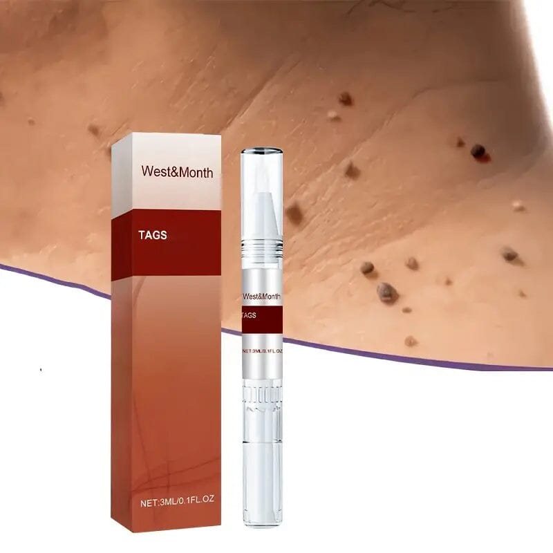 Skin Tag Removal Pen Online Online Cheap Online