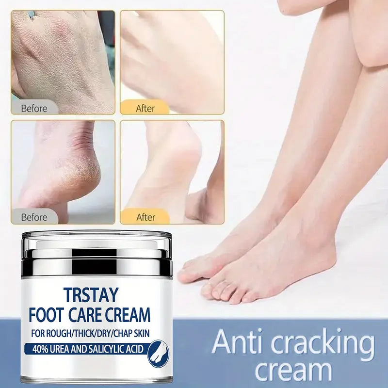 Trstay Foot Care Cream50g/ Foot Care Cream 40 Urea And Salicylic Acid Sast Online