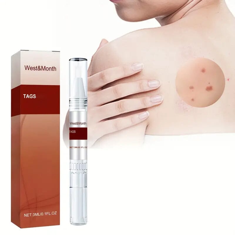 Skin Tag Removal Pen Online Online Cheap Online