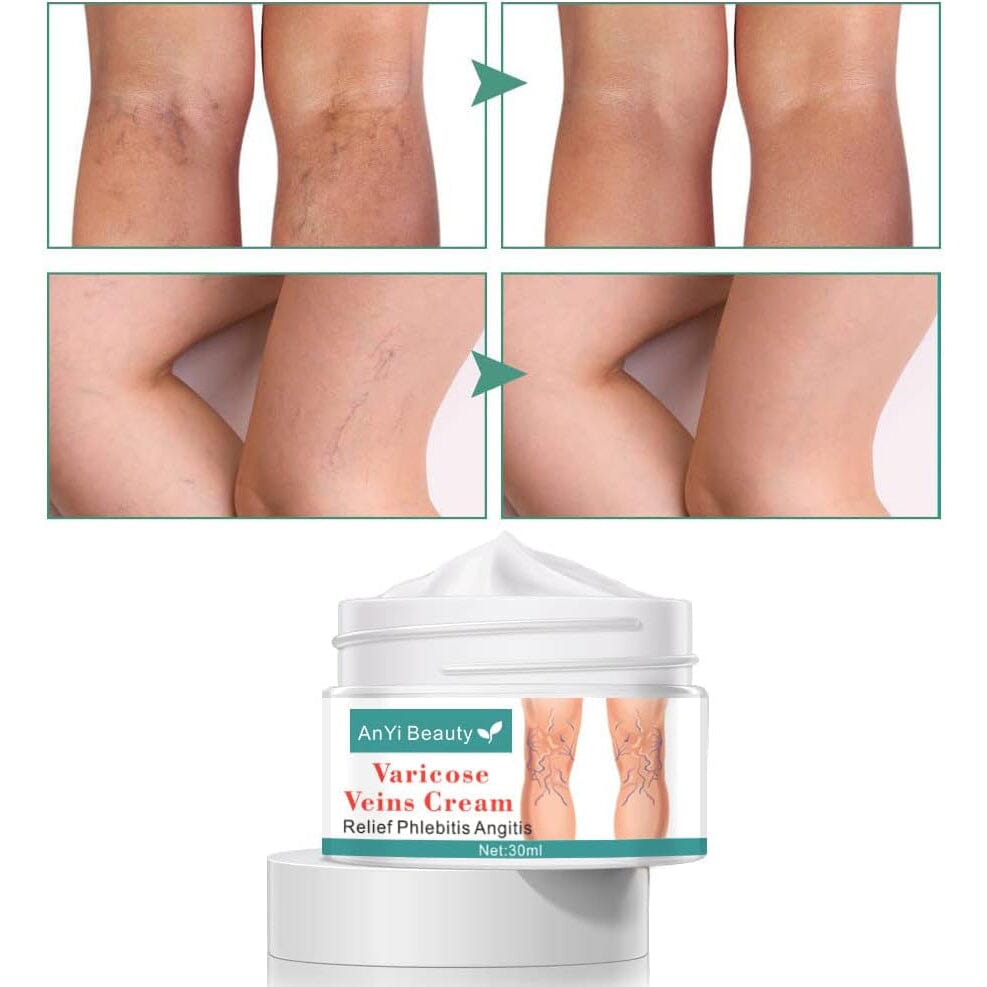 Varicose Deep Nourishing Soothing Vein Cream Outlet Locations Cheap Pice