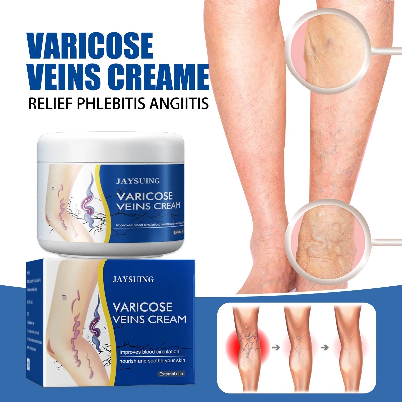 Pain Relief Leg Spider Veins Vasculitis Promote Circulation Smooth Metabolism 30g Exfoliation Cheap Best Store To Get