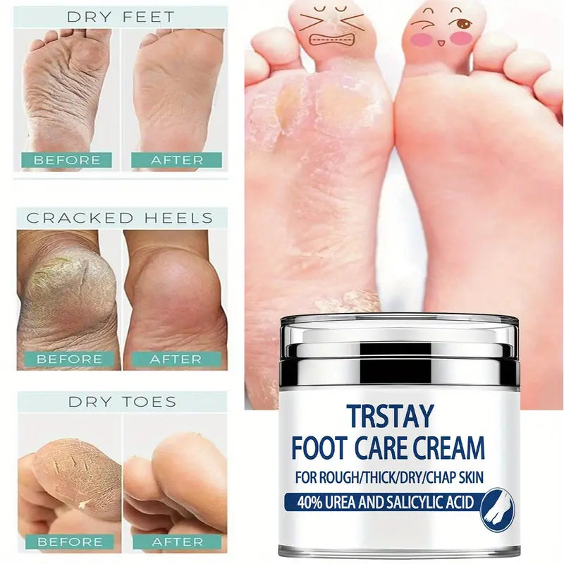 Trstay Foot Care Cream50g/ Foot Care Cream 40 Urea And Salicylic Acid Sast Online