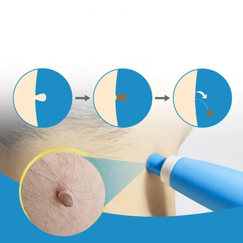 Advanced Auto Skin Tag Repair Kit Cheap Factory Outlet