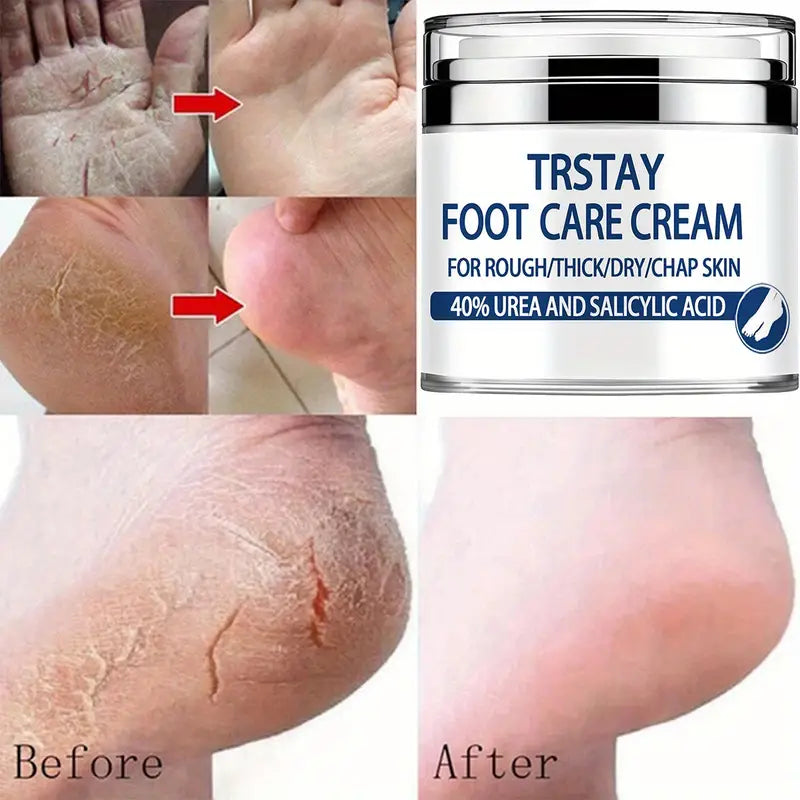 Trstay Foot Care Cream50g/ Foot Care Cream 40 Urea And Salicylic Acid Sast Online