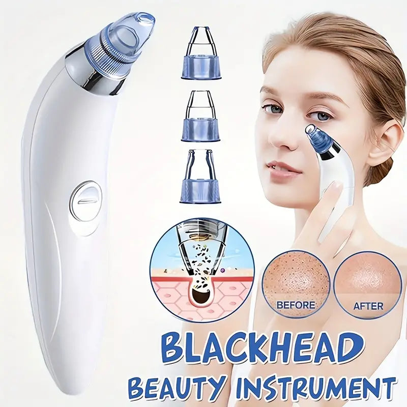 Blackhead Vacuum Remover, Powerful Portable Facial Pore Cleaner With 4 Probes Authentic Cheap Pice