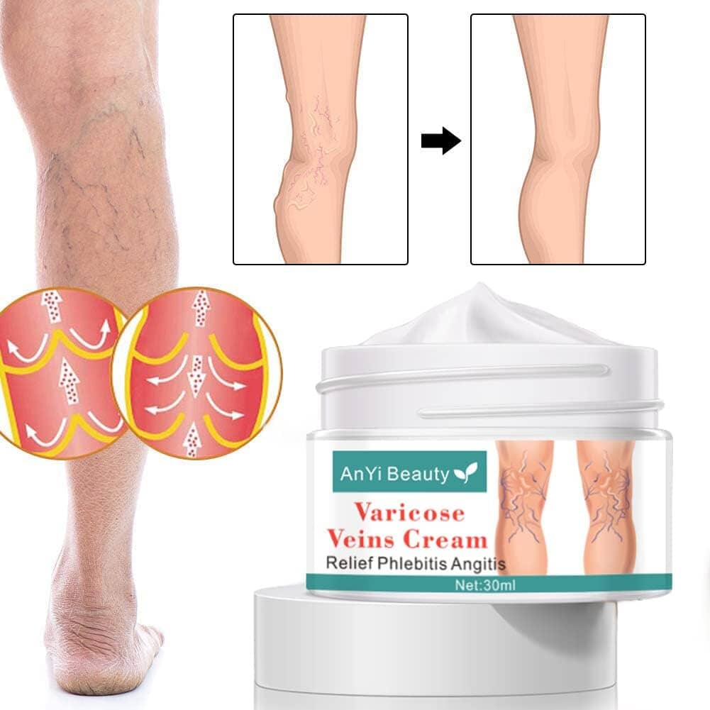 Varicose Deep Nourishing Soothing Vein Cream Outlet Locations Cheap Pice